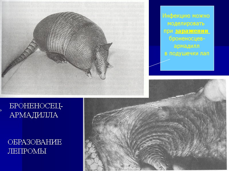 , БРОНЕНОСЕЦ- АРМАДИЛЛА ОБРАЗОВАНИЕ  ЛЕПРОМЫ Инфекцию можно  моделировать  при заражении 